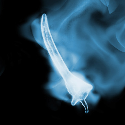 Графика Родион Иванов, Expecto Patronum